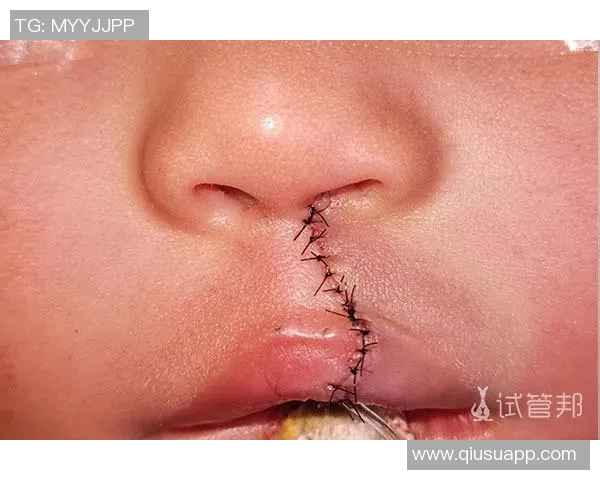 杜埃伤情乐观无需手术恢复时间预计为六到八周